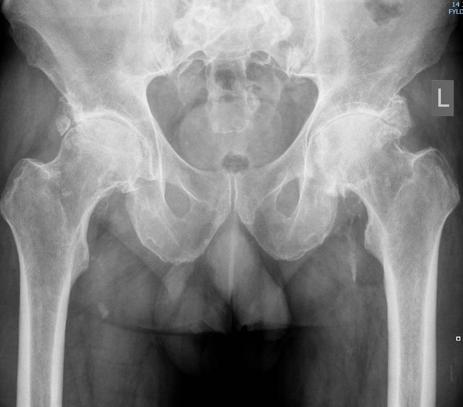 Hip or knee X-ray example