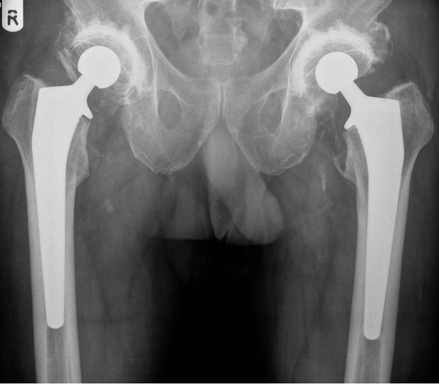 Hip or knee X-ray example