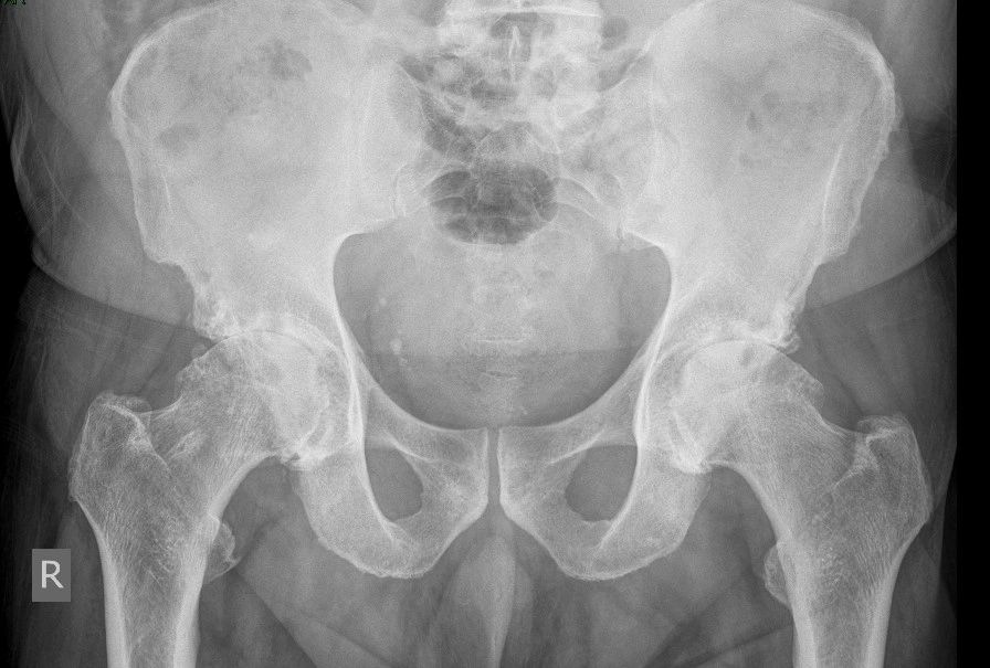 Hip or knee X-ray example