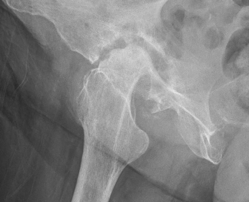 Hip or knee X-ray example