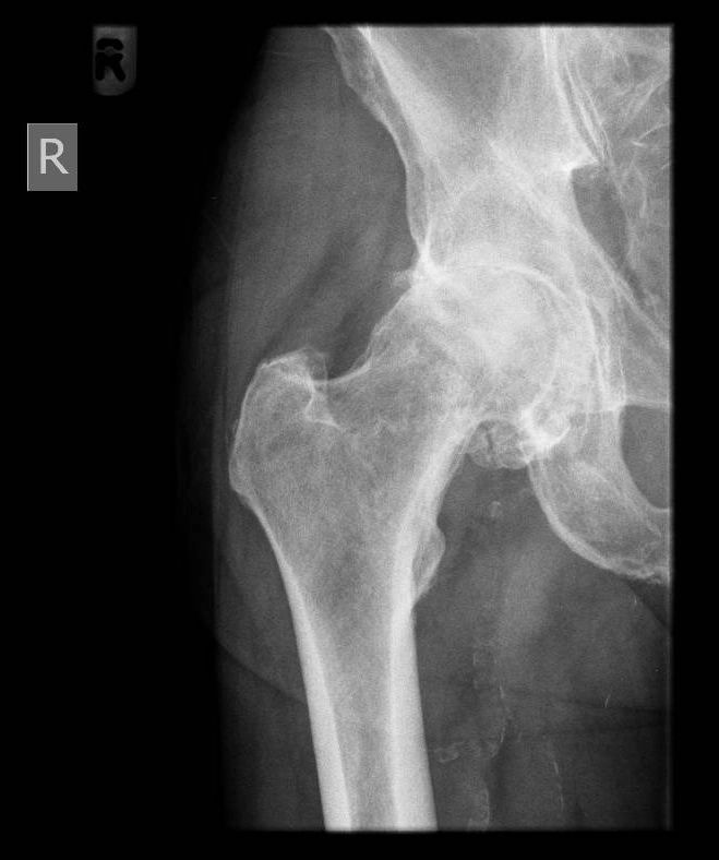 Hip or knee X-ray example