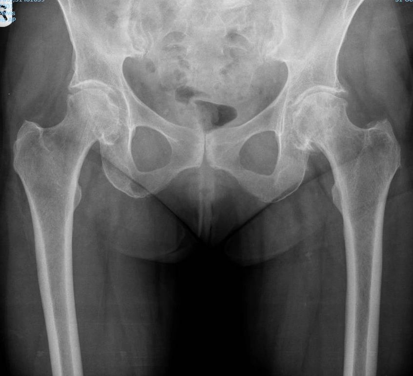 Hip or knee X-ray example