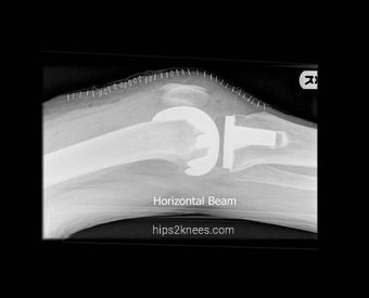 Knee X-ray example