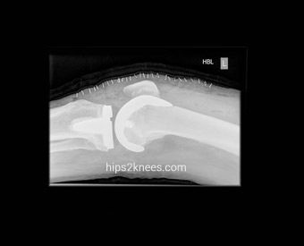 Knee X-ray example